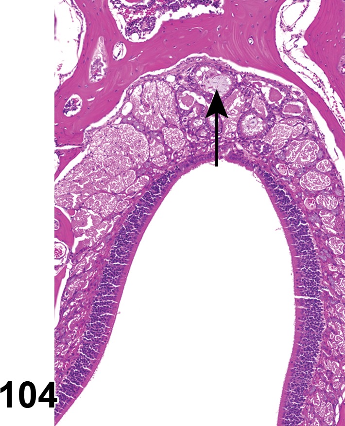 Figure 104.