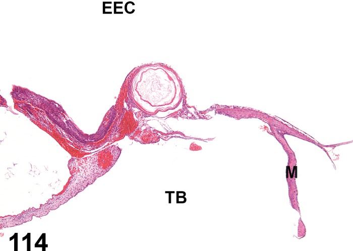 Figure 114.