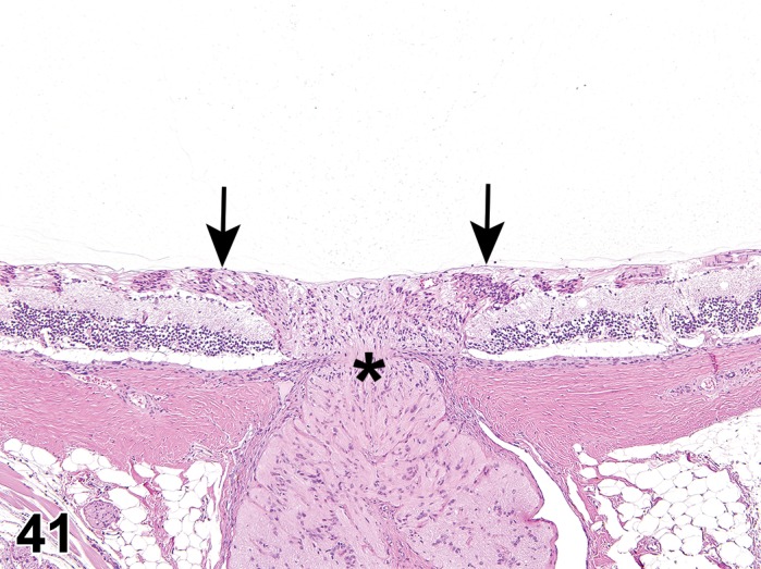 Figure 41.