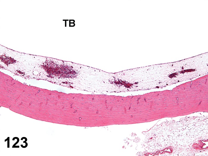 Figure 123.