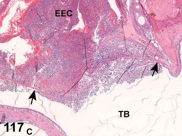 Figure 117.