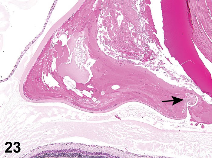 Figure 23.