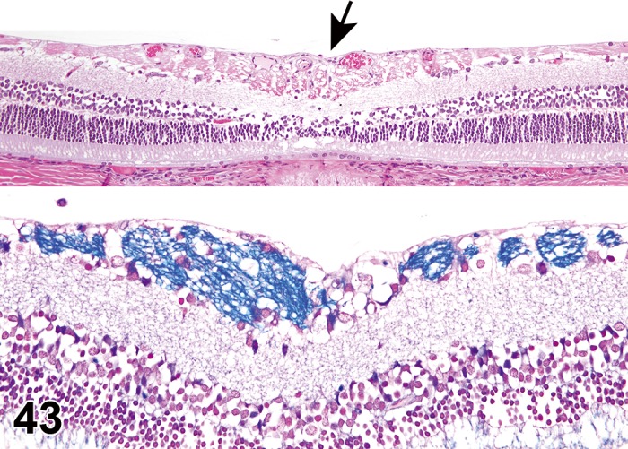 Figure 43.