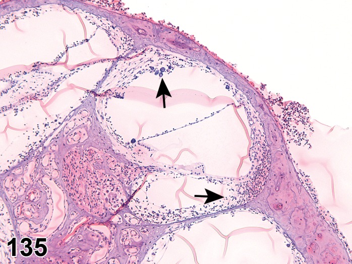 Figure 135.