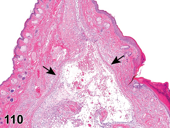 Figure 110.