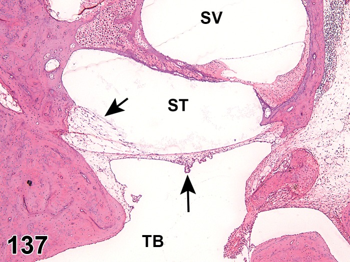 Figure 137.