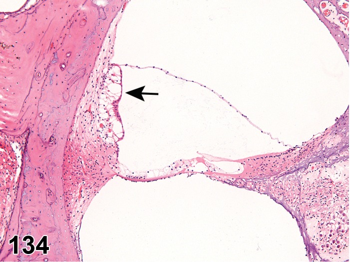 Figure 134.