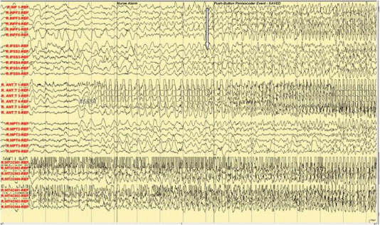 Fig. 4