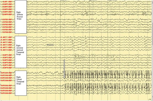 Fig. 2