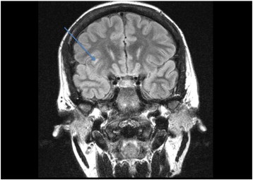 Fig. 7