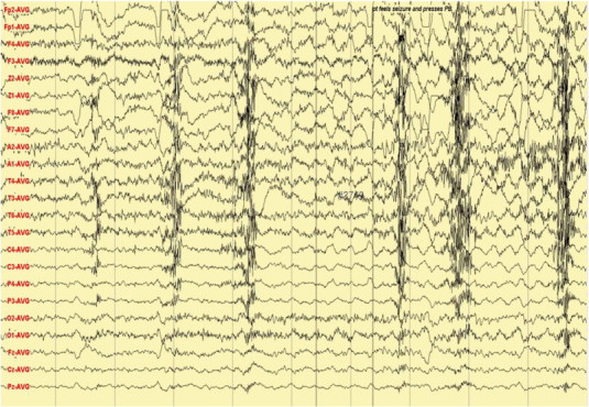 Fig. 1