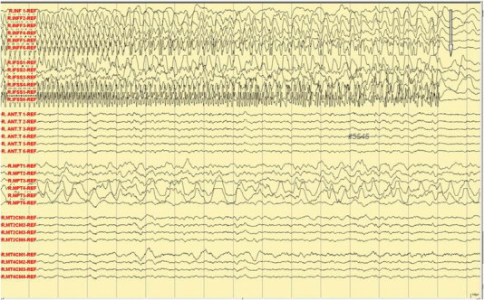 Fig. 6