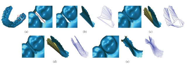 Figure 11