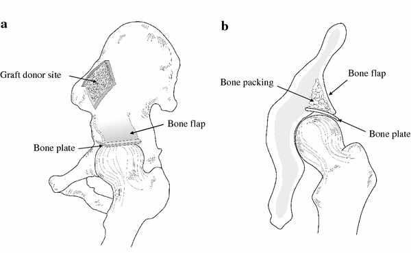 Fig. 1