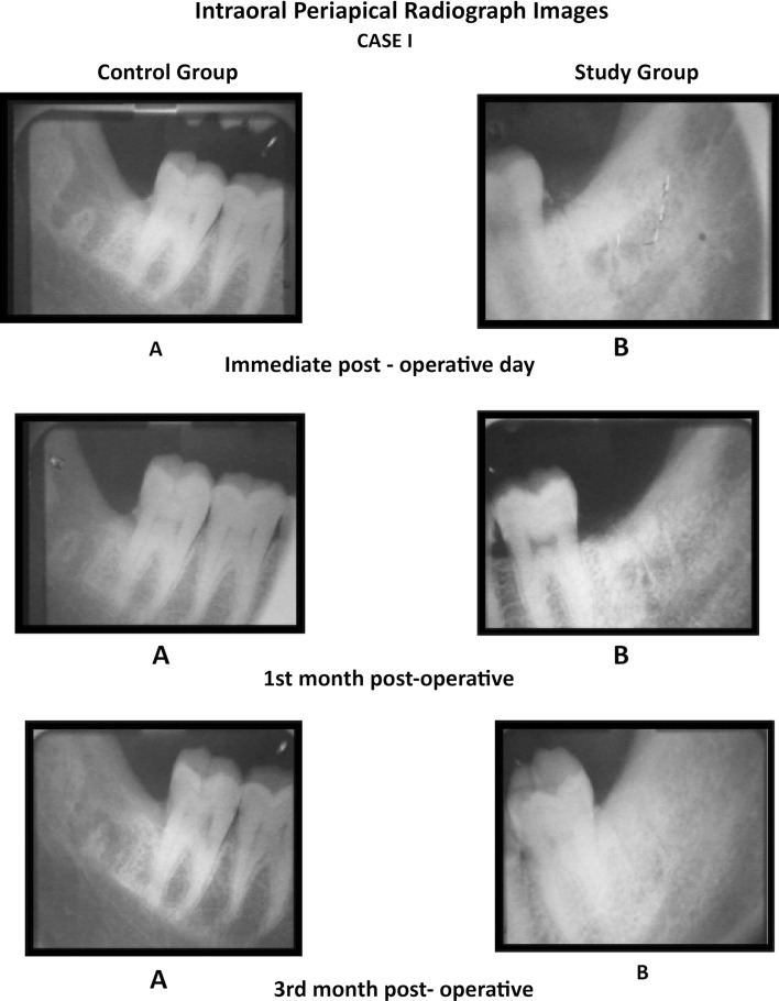 Case 1