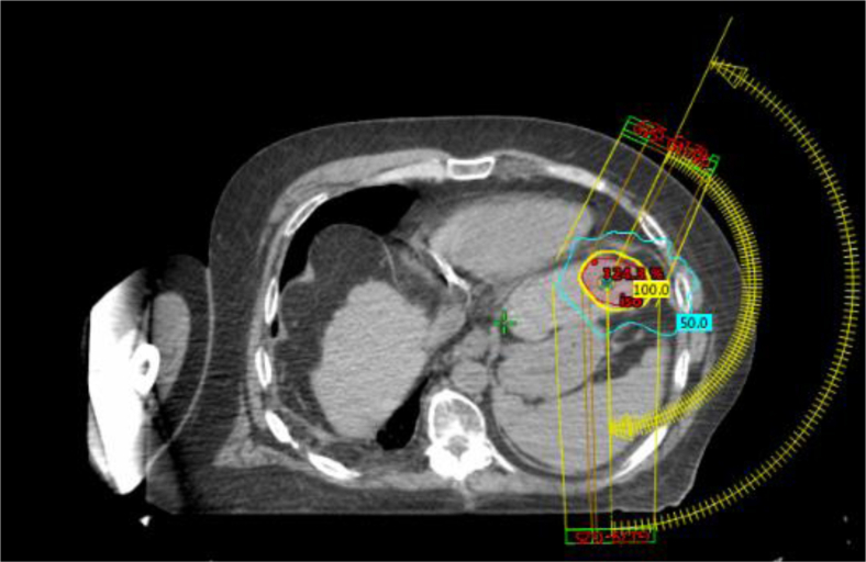 Figure 1