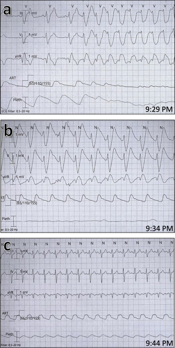 Figure 1