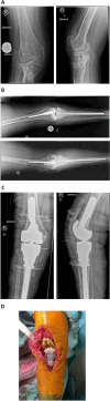 Fig. 9