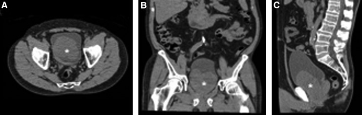 FIG. 1.