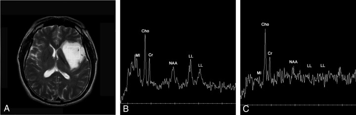 Fig 2.