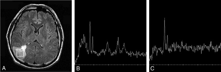 Fig 3.