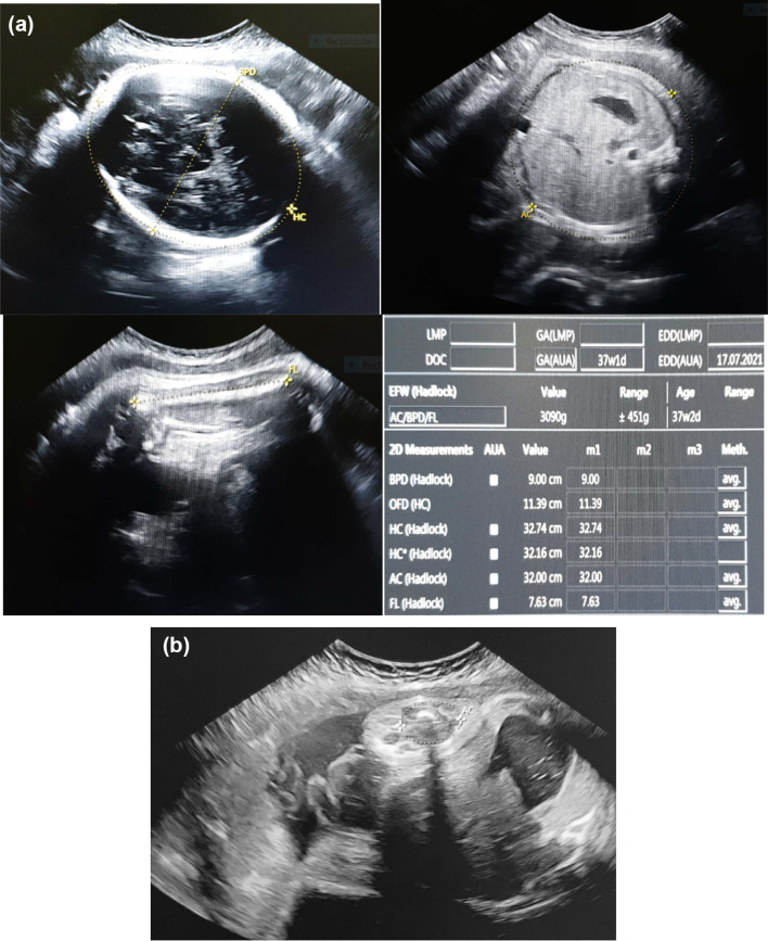 Fig. 5