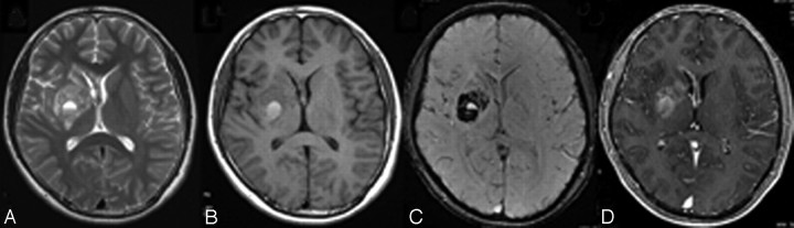 Fig 3.