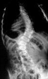 Fig. 3