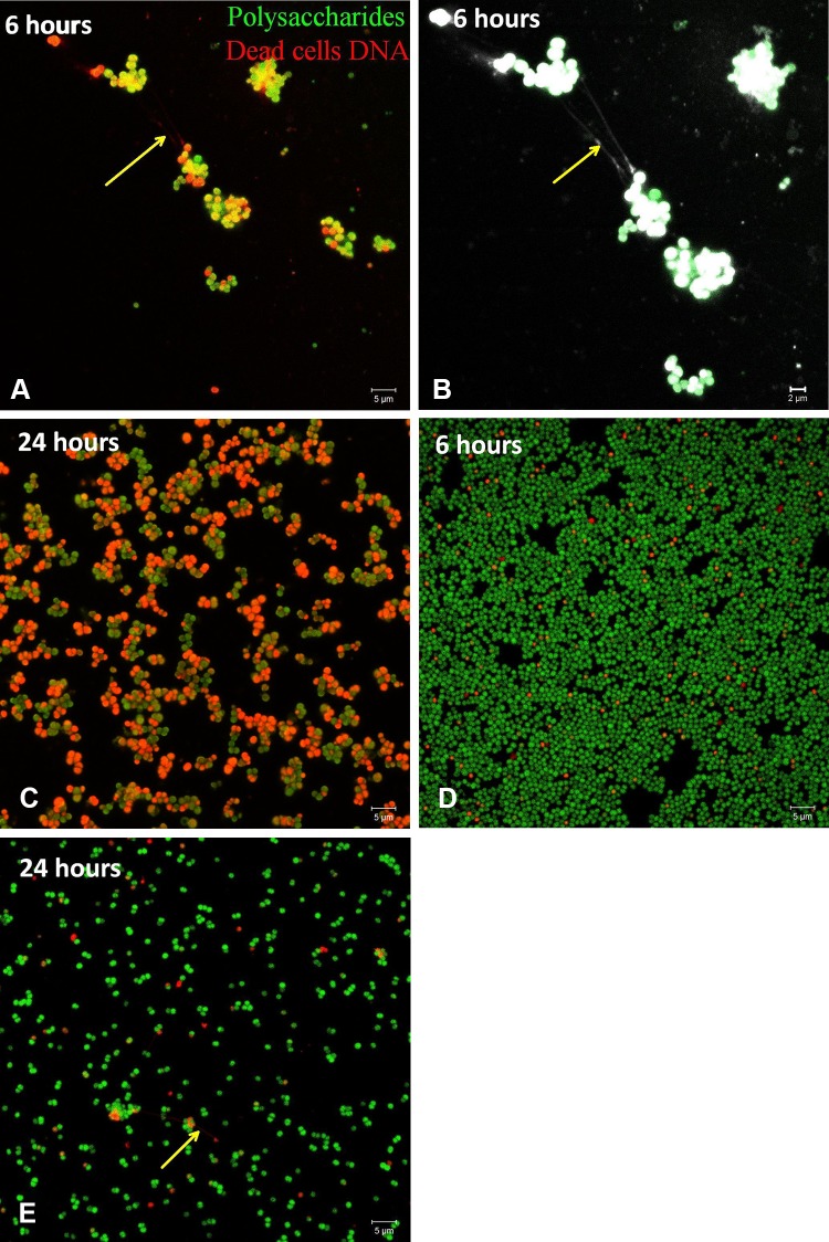 Fig. 1A–E