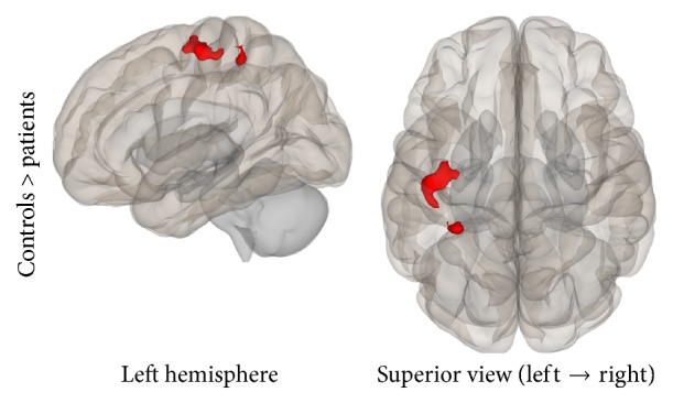 Figure 12