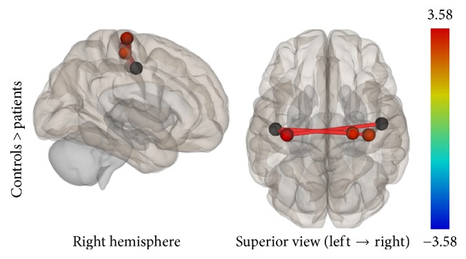 Figure 11