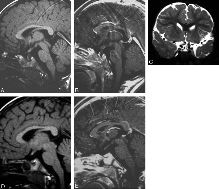 Fig 2.