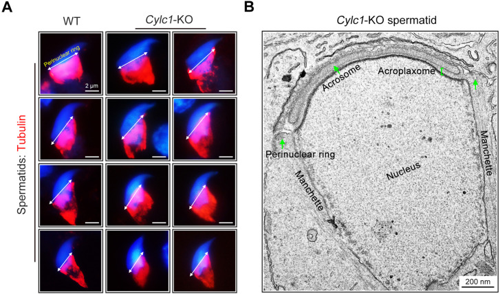 Figure 2—figure supplement 1.