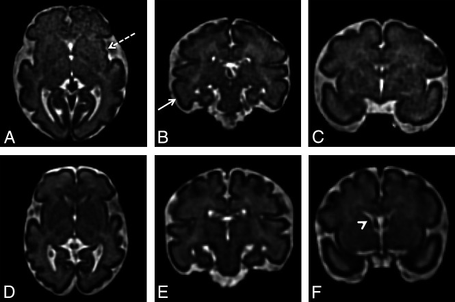 Fig 3.