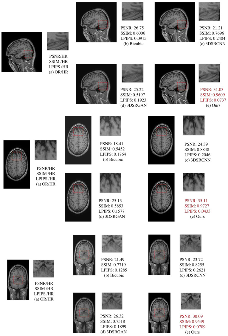 Figure 13