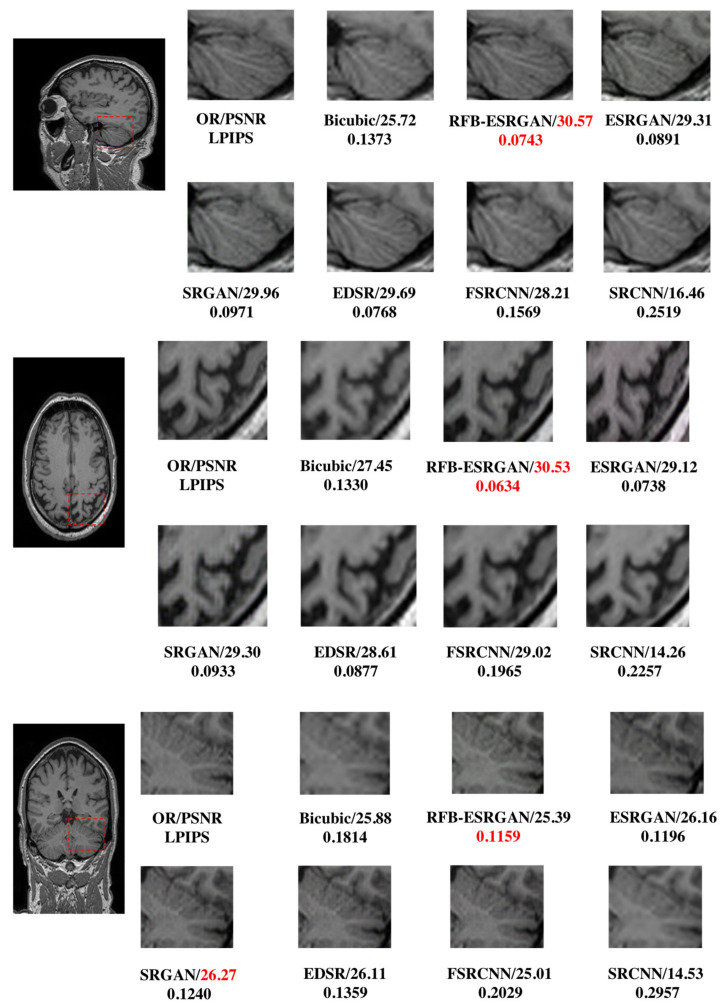 Figure 11