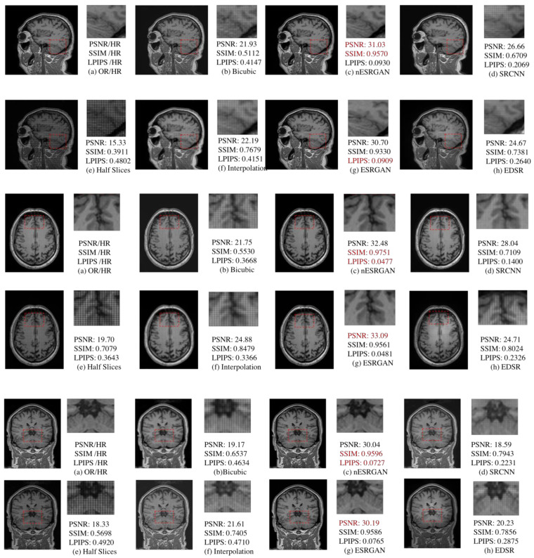 Figure 12