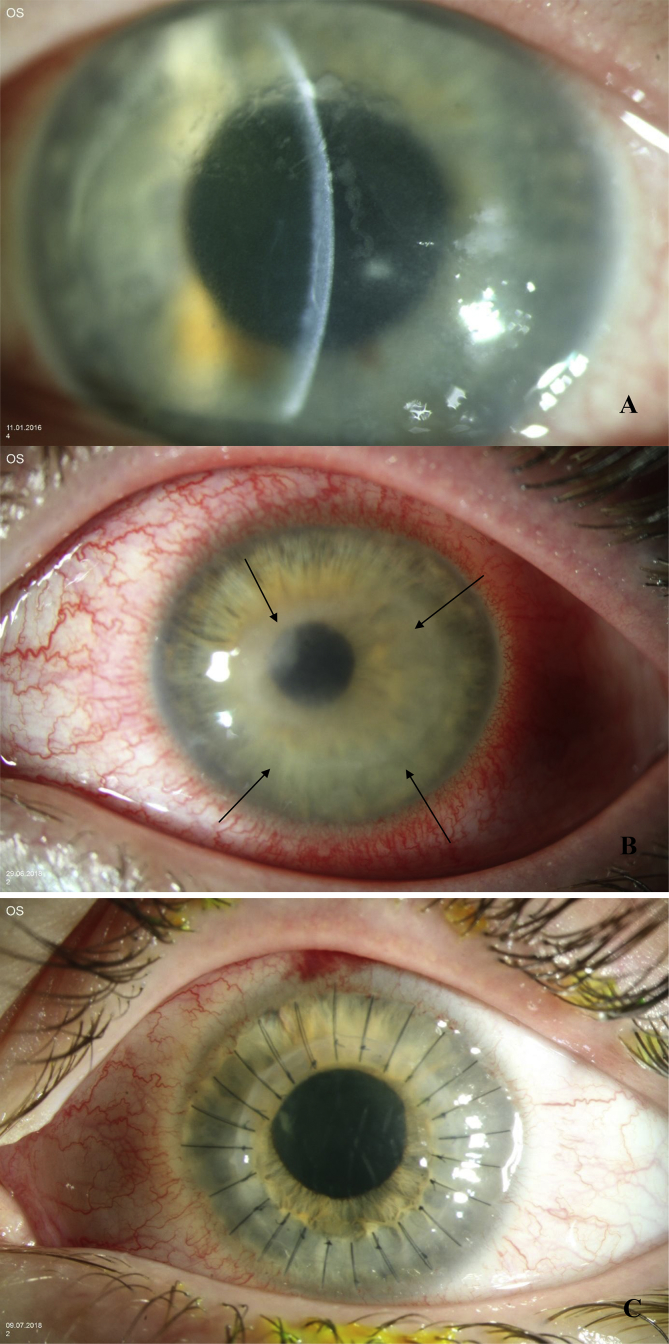 Fig. 1