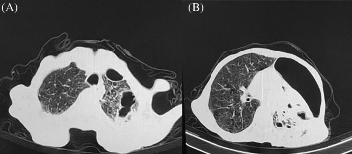 FIGURE 1