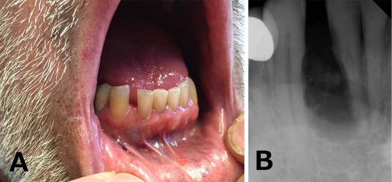 Fig. 1