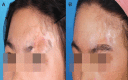 Figure 6)