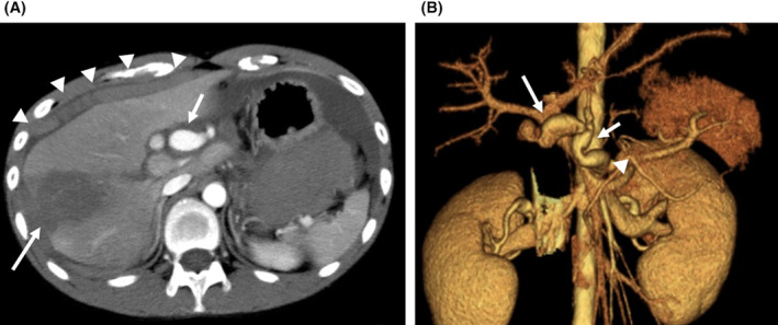 FIGURE 1