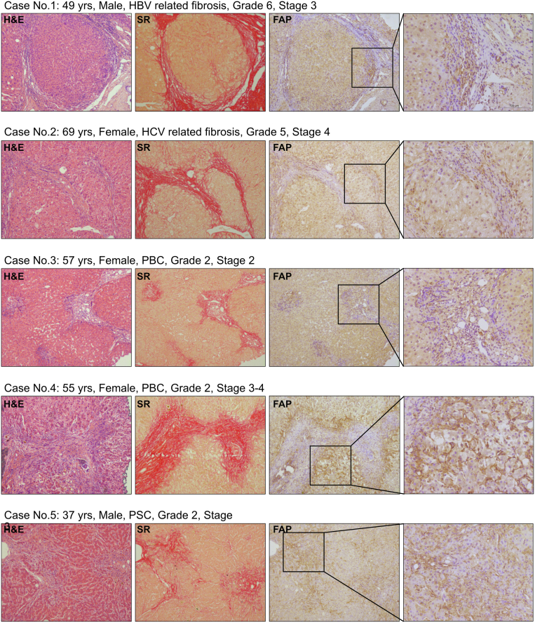 Figure 14