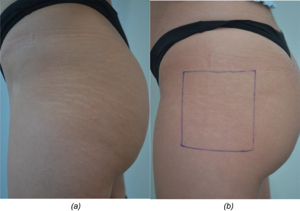 Fig. 9