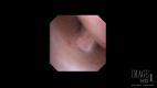 <b>FIG. 3.</b>