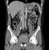 <b>FIG. 1.</b>
