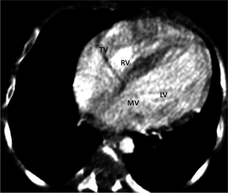 Fig. 4