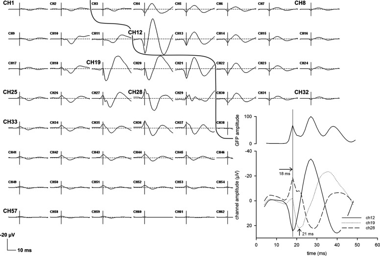 Fig. 2.