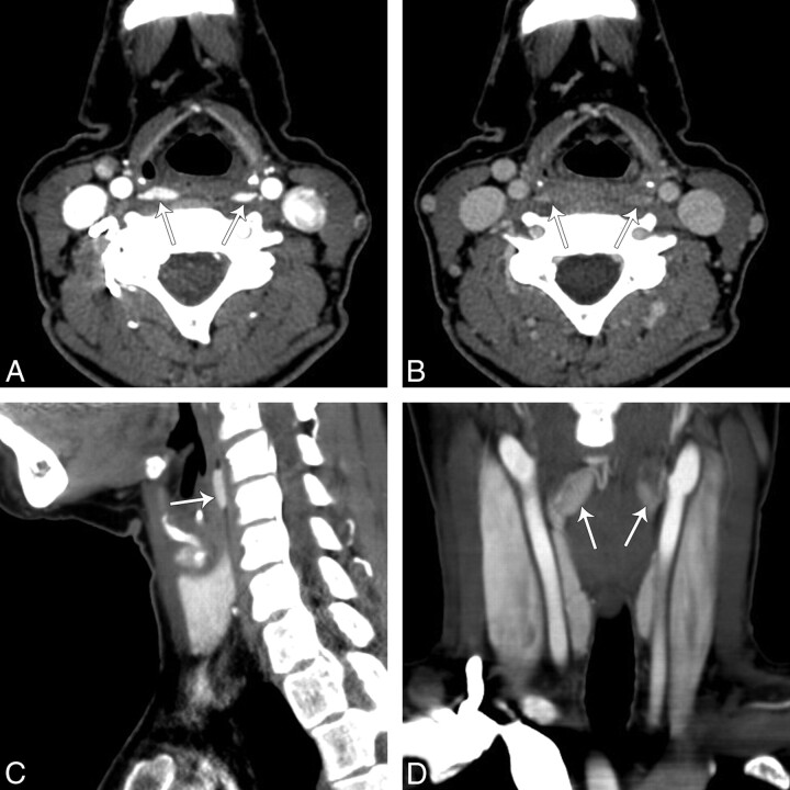 Fig 2.