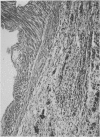 86-5